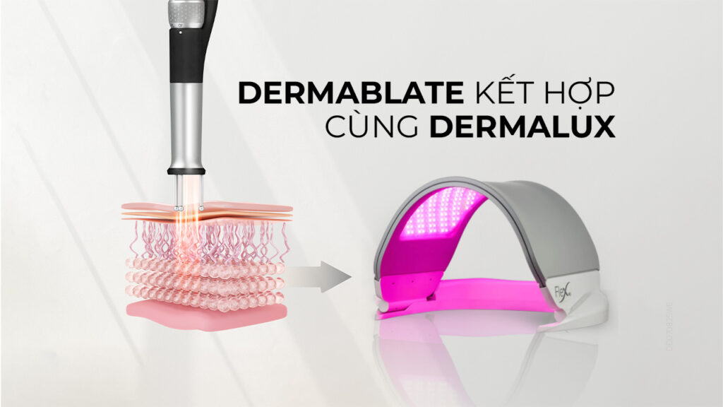 Dermablate kết hợp cùng Dermalux