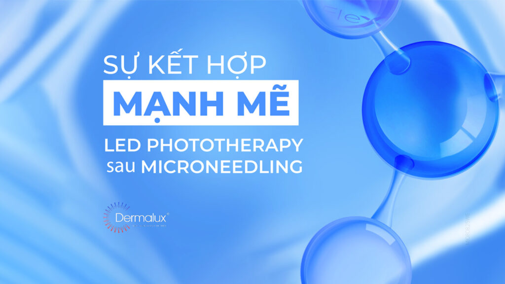 Microneedling kết hợp LED Phototherapy