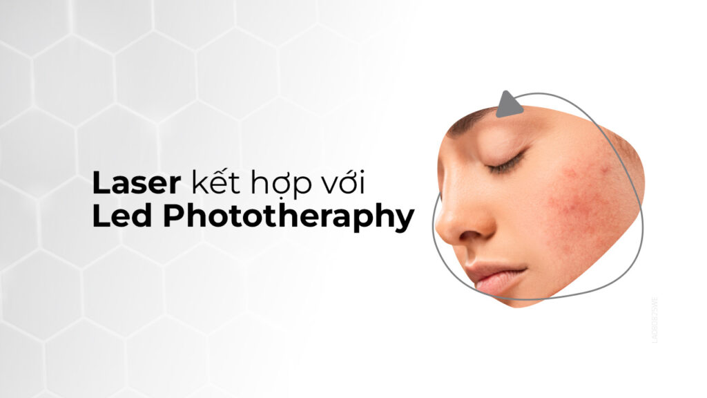 Laser kết hợp với LED Phototherapy