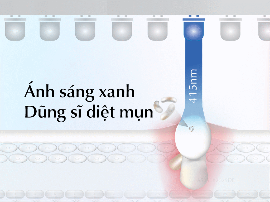 dermalux-dieu-tri-mun