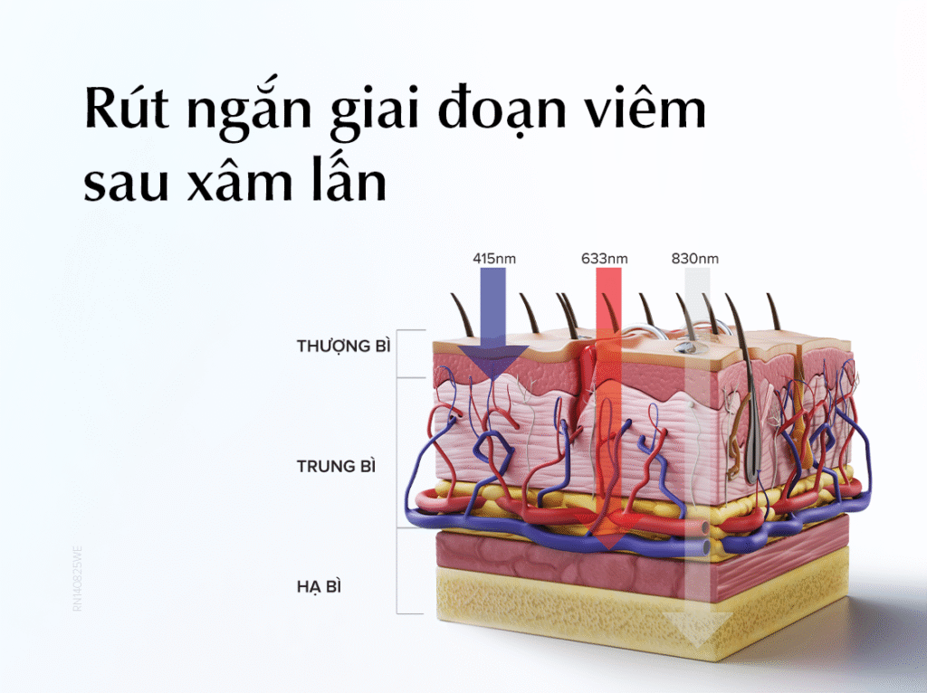 rut-ngan-giai-doan-viem-voi-dermalux