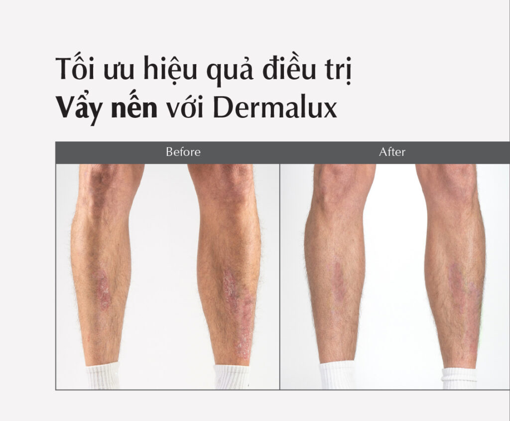 [VA080825FA]_BIAWEB_VAYNEN