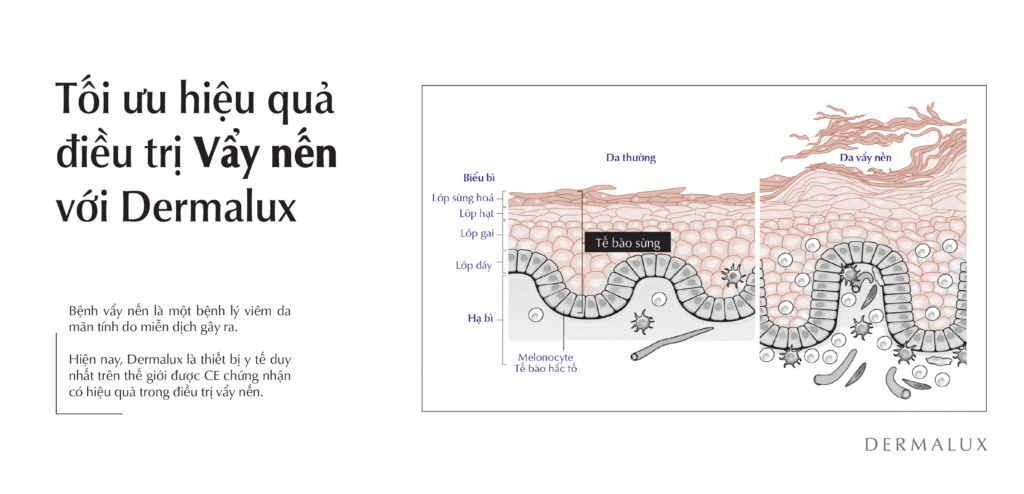 [VA080825FA]_TRONG_VAYNEN-01